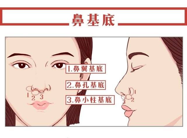 鼻基底注射怎么打不疼？