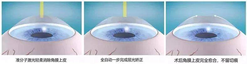 广州眼科近视手术医院哪家最好?前10排行TOP榜单,2025年版来了~