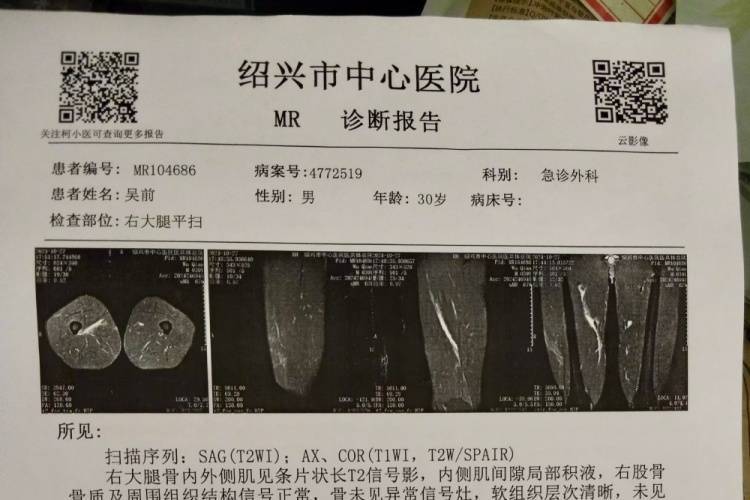 浙江公布吴前伤情：右腿骨内外侧肌水肿 伤停三周