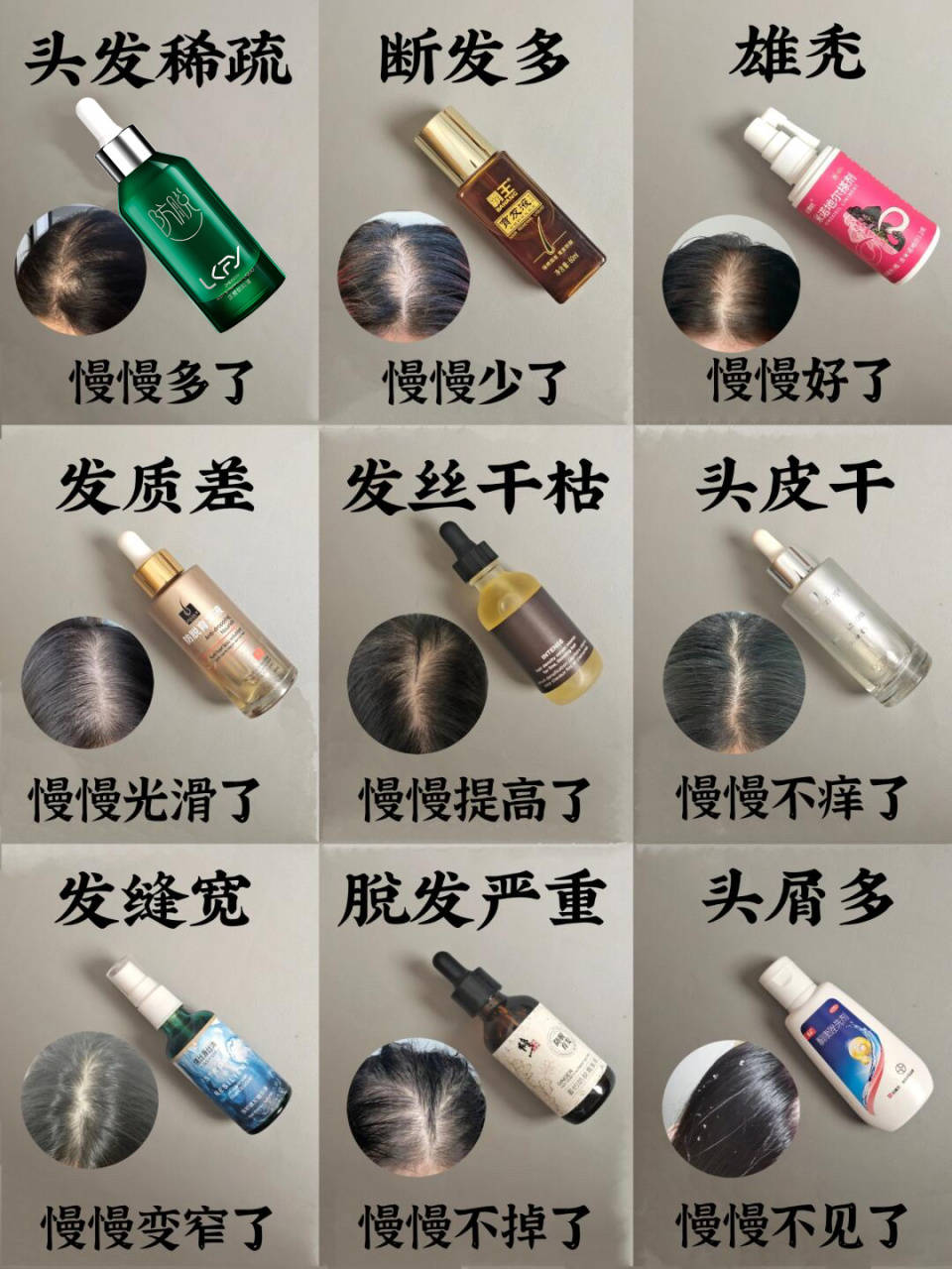 防脱生发最好的品牌有哪些？早发现早干预