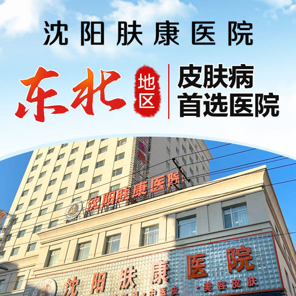 治疗皮肤病专业医院：沈阳东城（肤康）皮肤医院好吗？