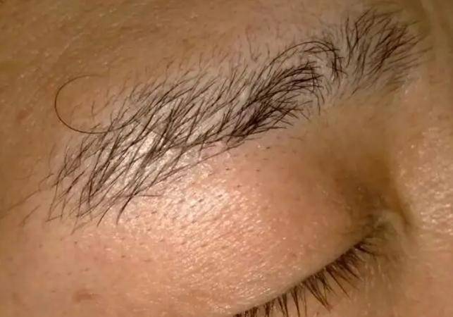 短;眉如扫帚,阳气已衰。"意思是说眉毛形状异常往往暗示身体机能衰退。中医典籍《黄帝内经》也提到面部特