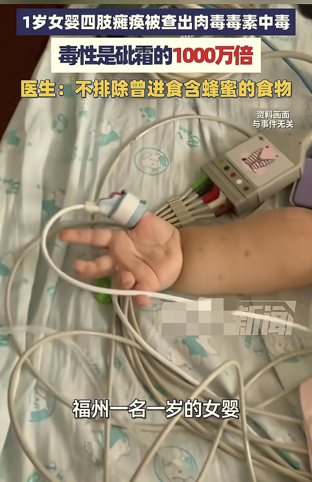 哪九种食物不适合当孩子的辅食呢?新手爸妈要牢记