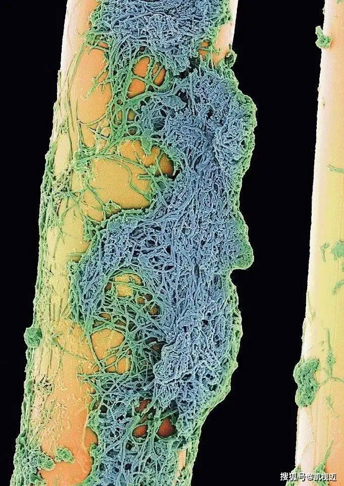 显微镜下的微生物世界：微观中的大宇宙