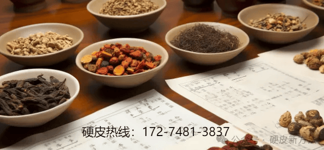 得了硬皮病怎么办？吃什么药效果好？