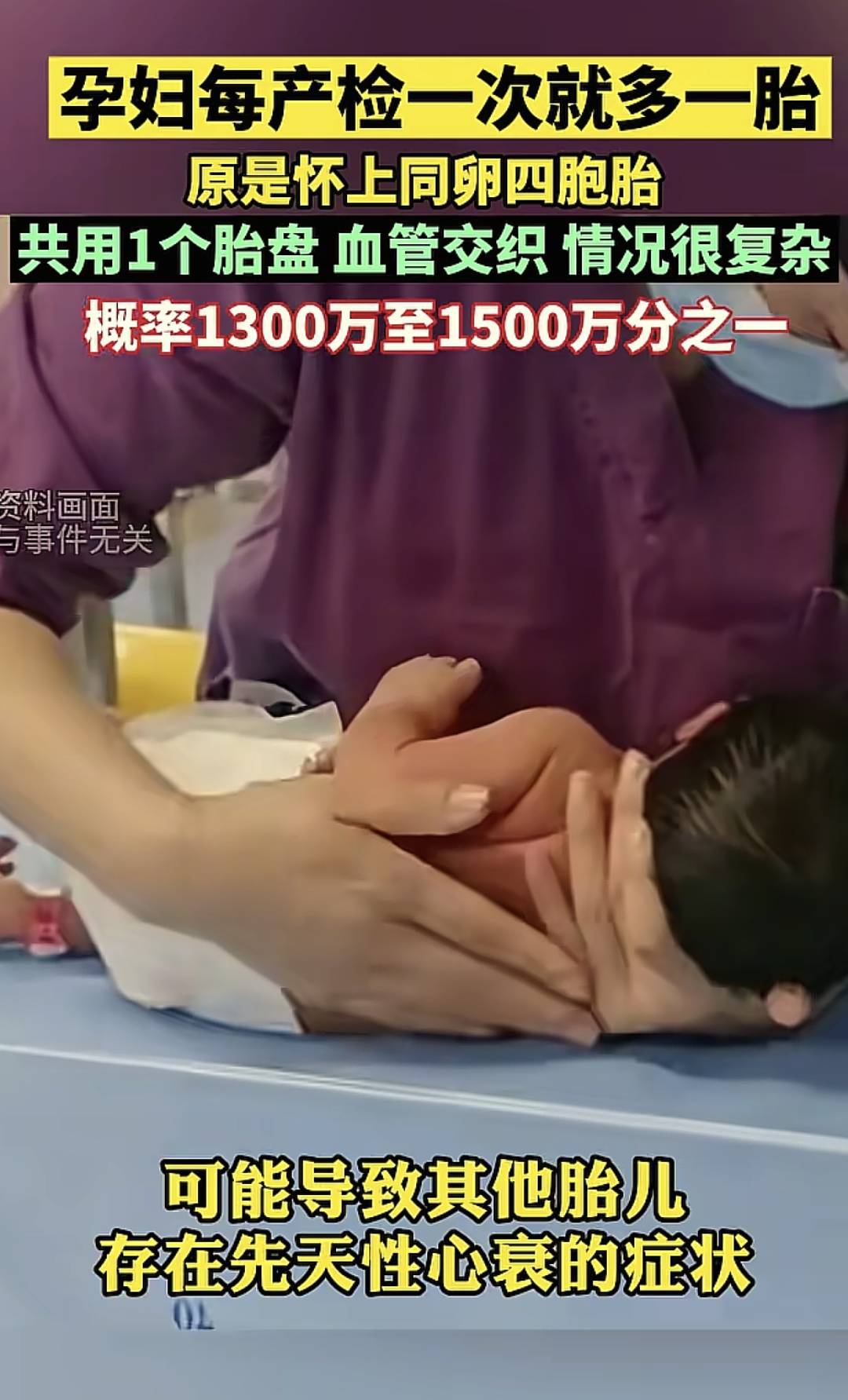 孕妇每产检一次就多一胎,原是怀上同卵四胞胎,医生摇头:要不了