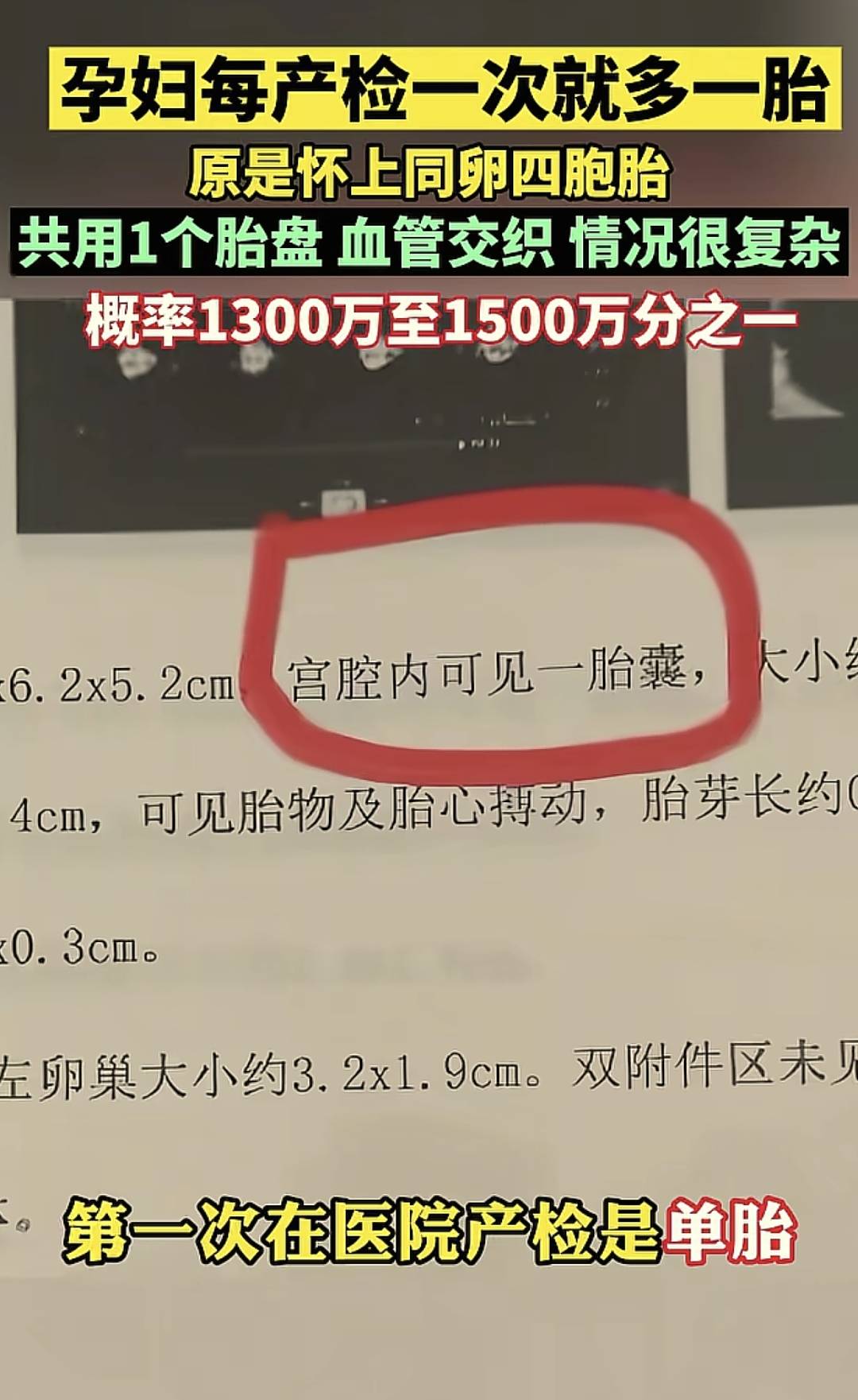 孕妇每产检一次就多一胎,原是怀上同卵四胞胎,医生摇头:要不了