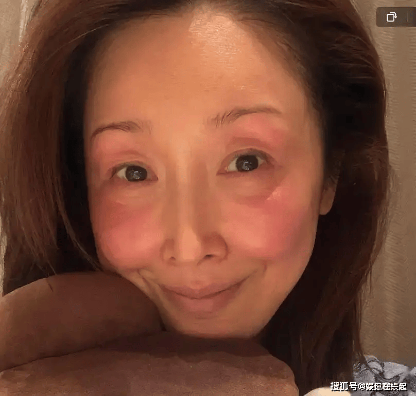 春晚录制出现事故！知名女歌手面部已毁，让人担心的事情发生了