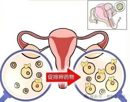 短时间多次取卵，卵子质量会不会打折？
