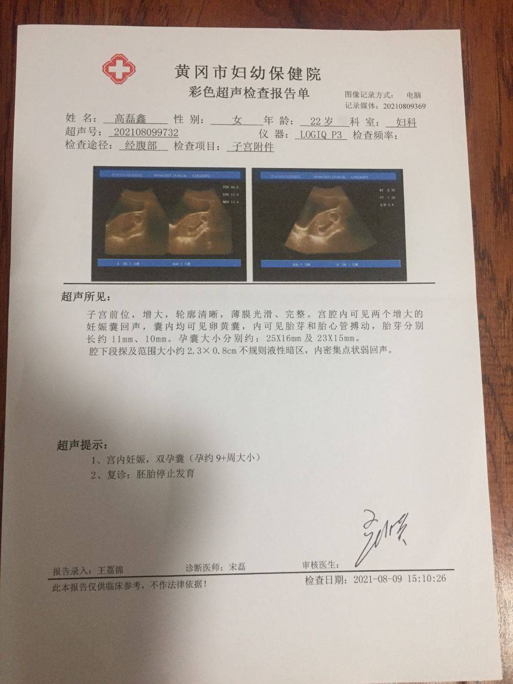 怀孕了b超单怎么看呢？