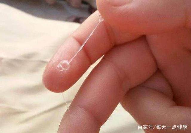 且白带发黄、有异味，其实这些症状都是在提醒你，可能患上了妇科炎症。