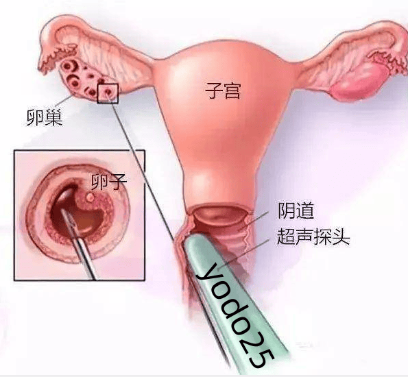 深圳供卵试管婴儿技术的现状与未来展望 深圳供卵试管婴儿技术的现状与未来展望