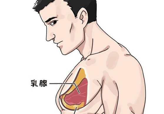 关注男性乳腺健康：乳腺发育不容忽视(图1)