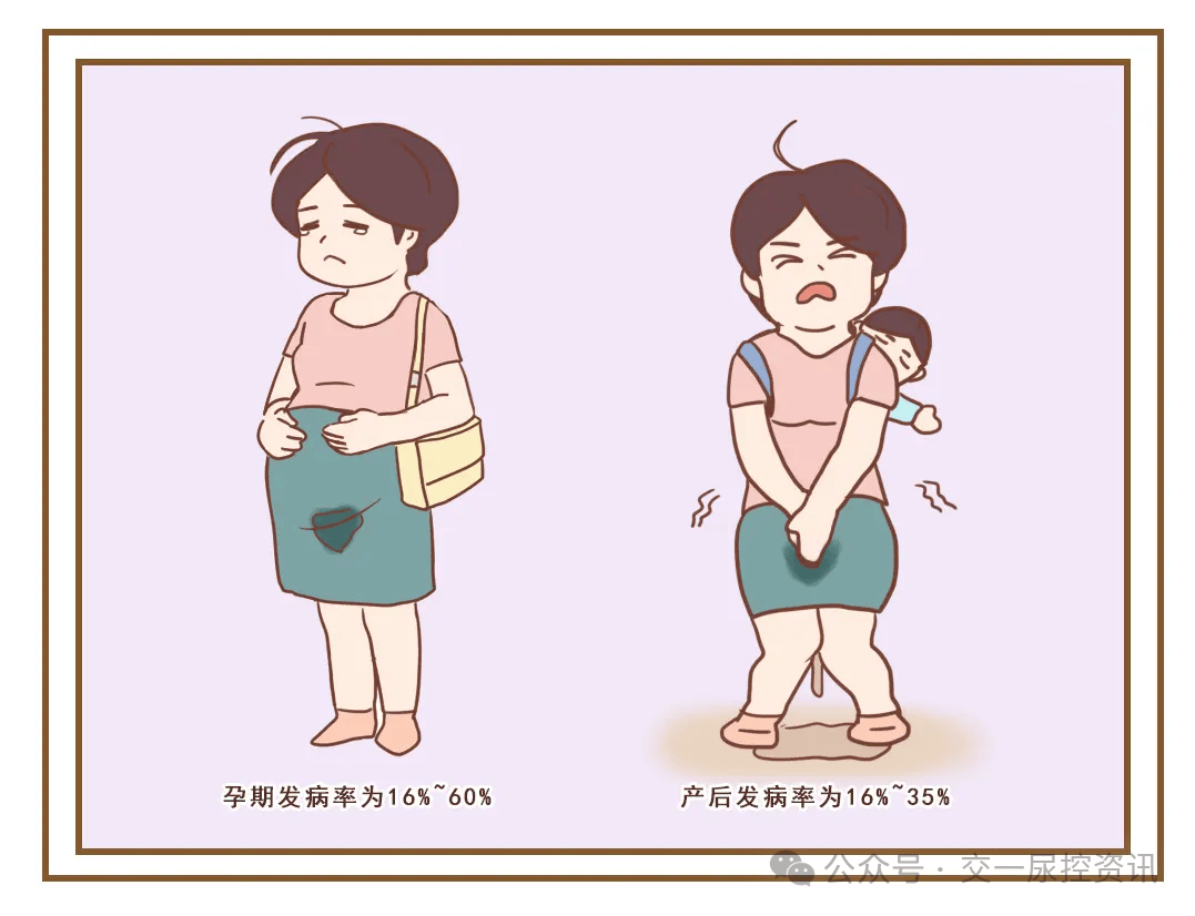 产后漏尿怎么办？如何治疗效果好？