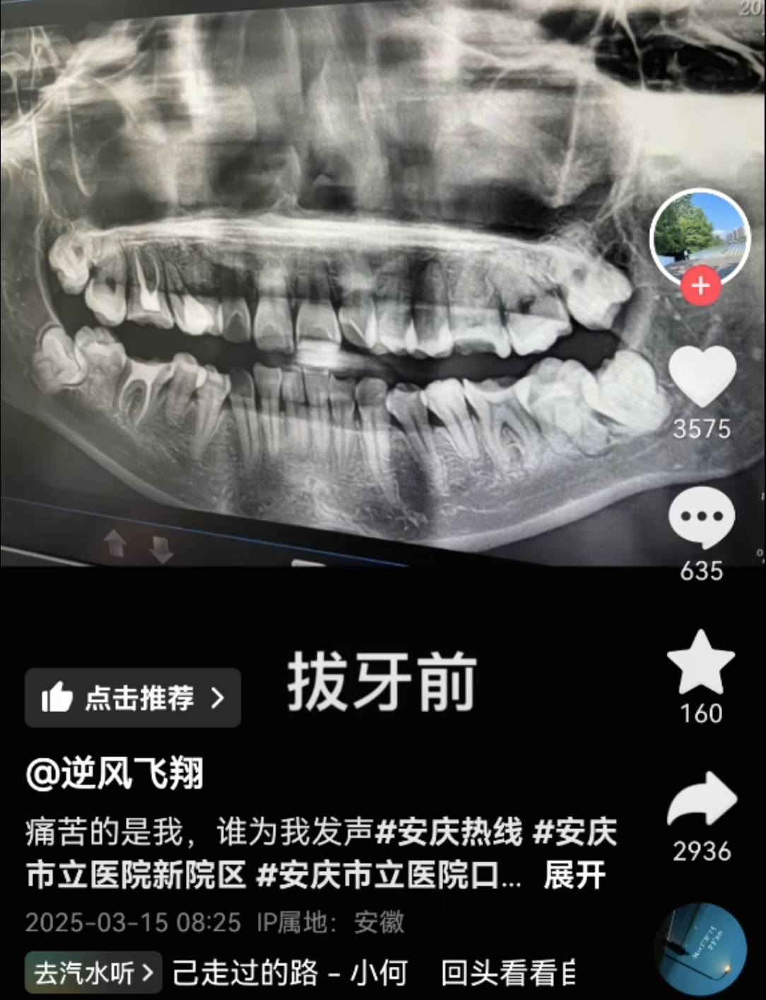 最新后续来了！被拔错牙坠亡女子家属与相关方和解