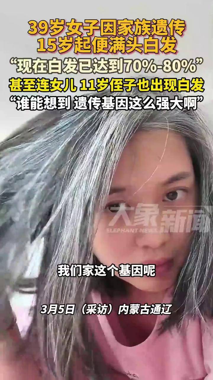 女子因家族遗传15岁起便满头白发，女儿和侄子也开始长白发