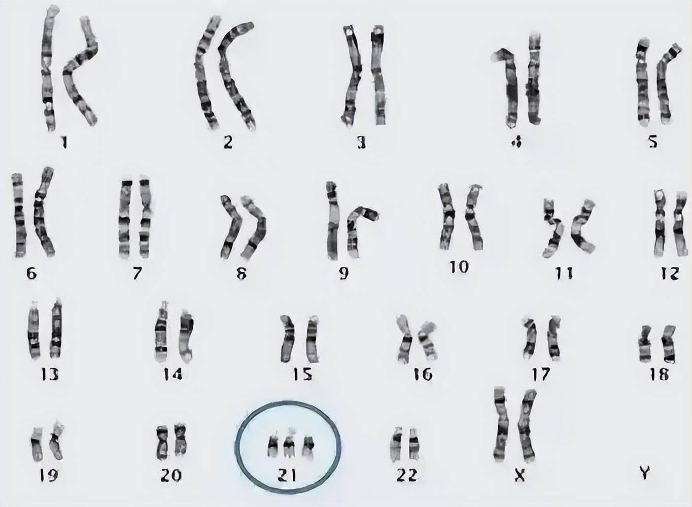 深度科普：为何人类比猿少两条染色体？难道进化论错了？