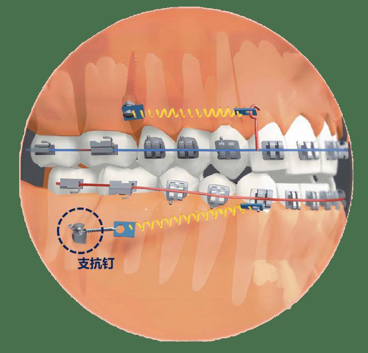 小火箭代理分享什么意思