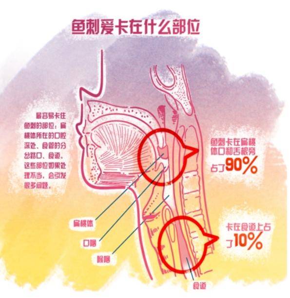 别再被这些"土方法"误导了!最正确的做法都在这_湖南省_食管_喉咙