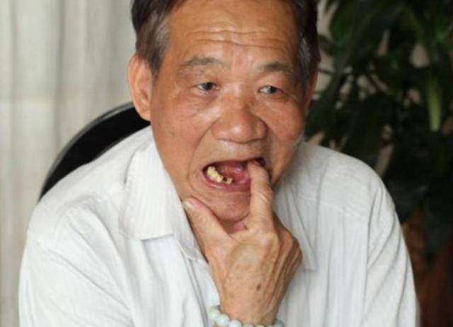 60歲後,牙齒剩多少顆才正常?看看及格沒_口腔_缺失_治療