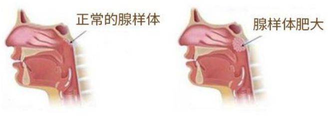 藥王烙:有種醜叫做