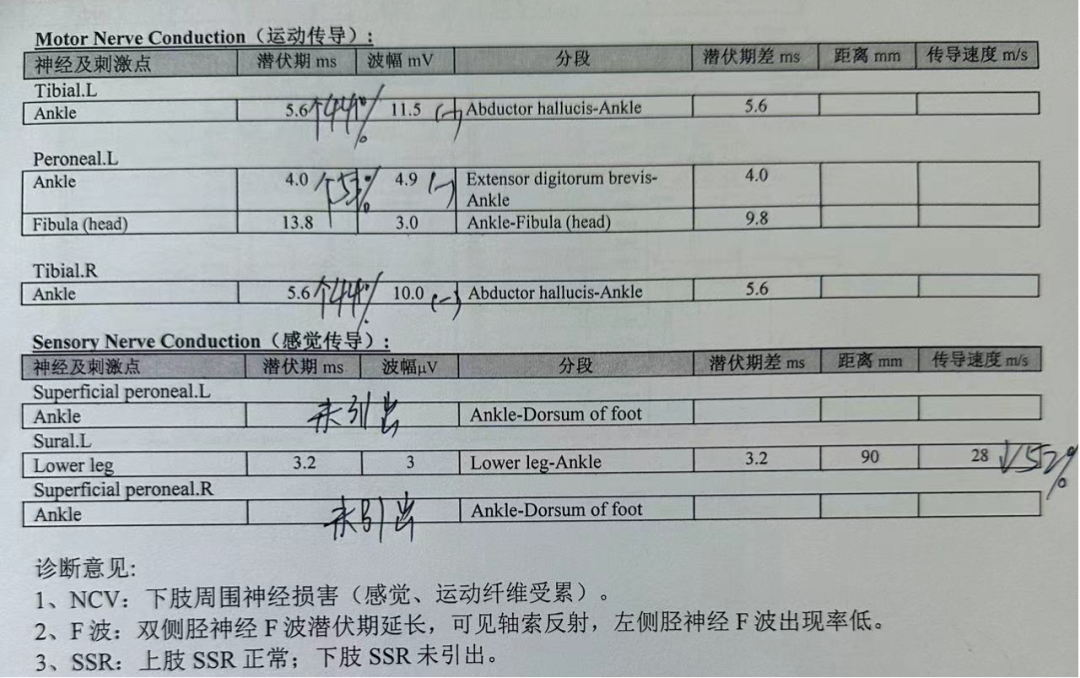 下肢周圍神經損害肌電圖顯示:神清語利,雙下肢腓管,踝管,趾管tinel徵