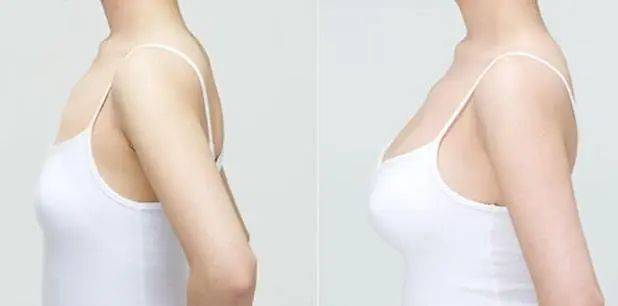 秘诀揭晓:告别平胸,拥有性感曲线的有效方法_胸部_运动_线条