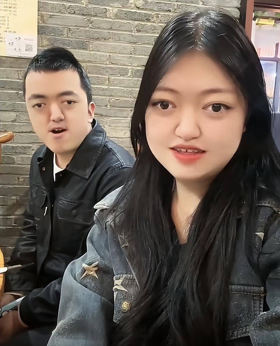 因患病长相特殊长期被网暴,熬夜后突发猝逝