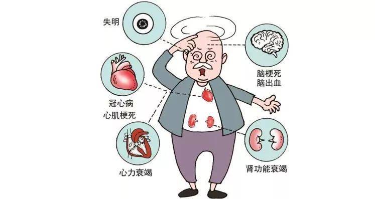 高血压180严重吗?