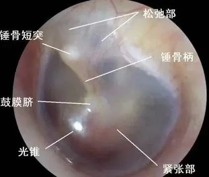 耳内镜检查疼不疼?