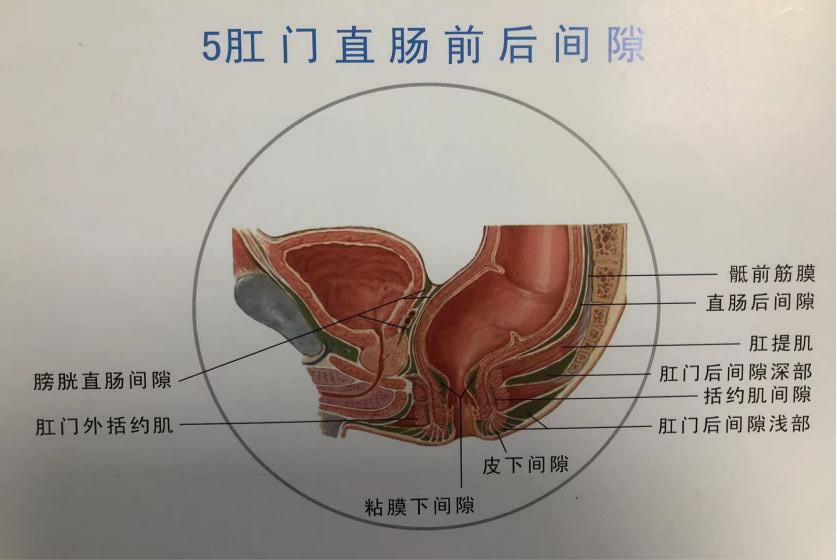 肛瘘长在什么位置图片图片