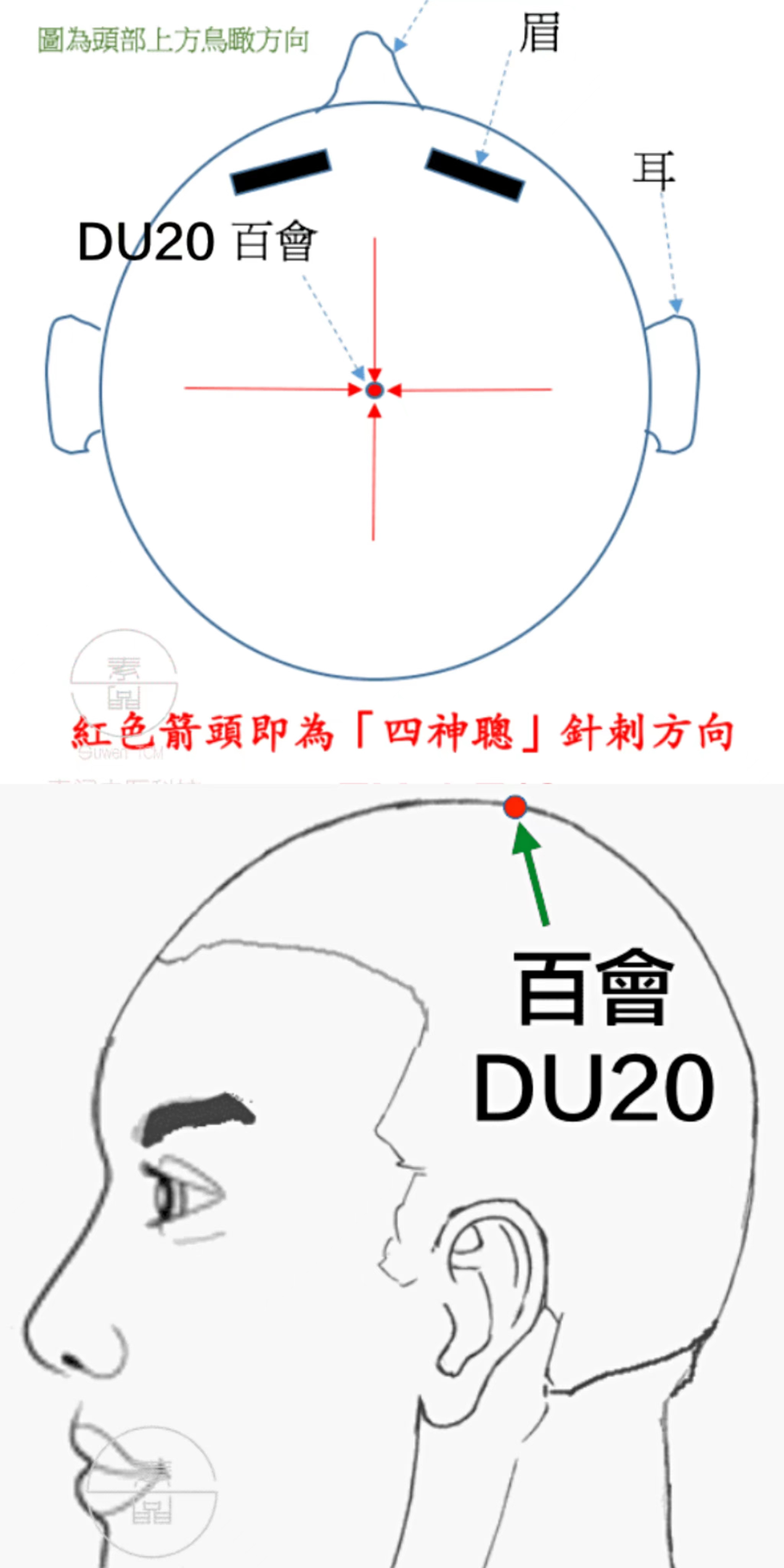 一針二穴 | 我學倪師透針透穴的個人筆記,共31條_治療