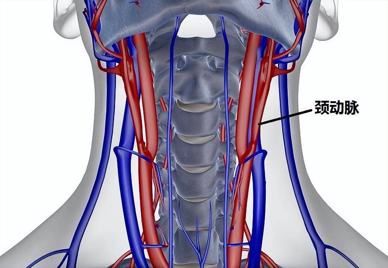 颈动脉狭窄怎么形成的?要如何治疗?