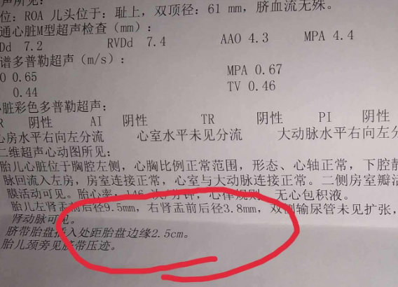 孕期,孕妇有3个"情况",可能是"小情人"在传信,早