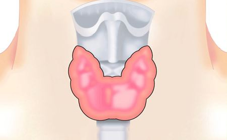 體檢查出甲狀腺結節怎麼辦?|廣州粵波醫院甲狀腺科謝