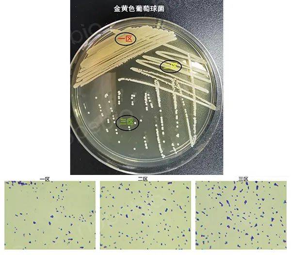 微生物试验用菌的挑选及注意事项_培养基_接种_平板