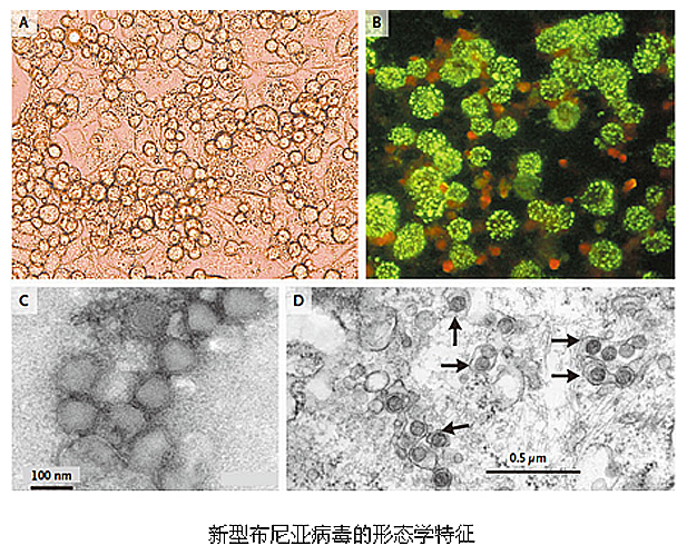 目前該傳染病常用的診斷方法是病毒分離,酶聯