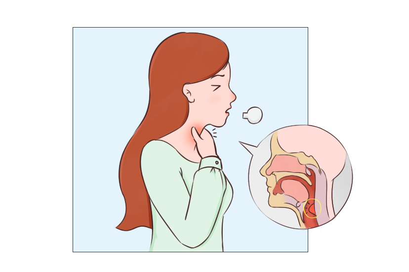 咽喉有异物感,反复清嗓子会对咽喉造成伤害!