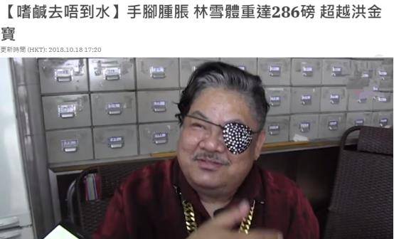 58岁林雪近照脸上现黑斑,体重超270斤,满身肥肉肚大如球引担忧