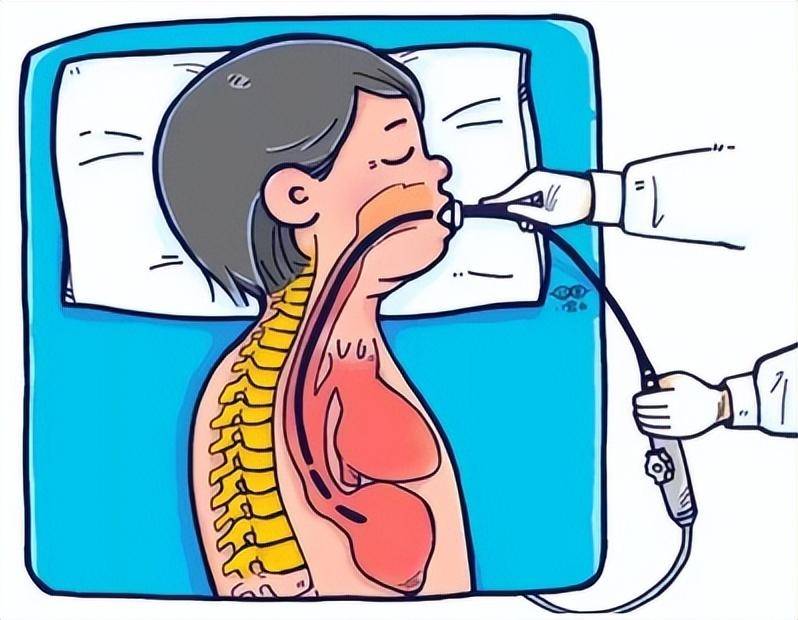 3分钟带你了解经食道超声心动图检查_食管_心脏_湖南省