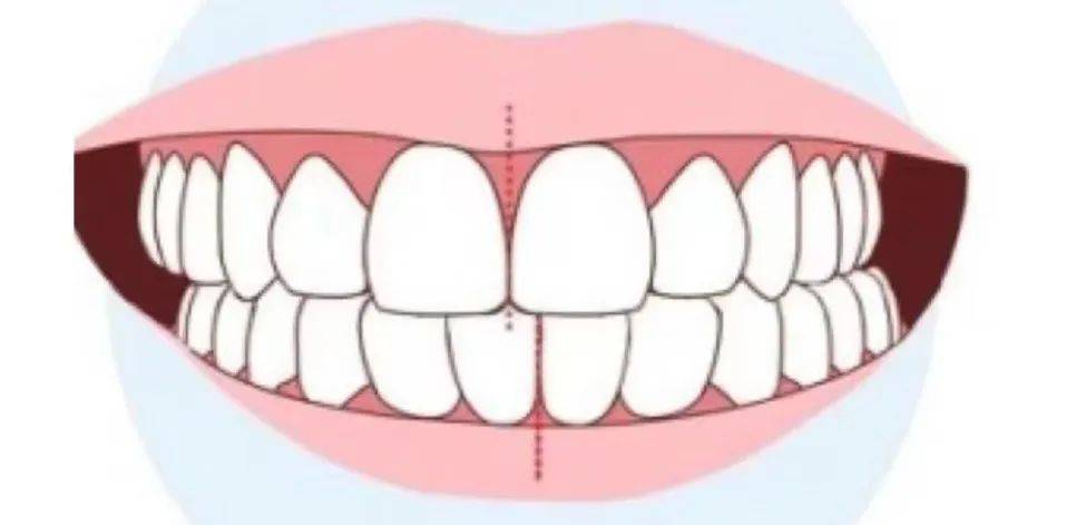正常牙齿咬合图 正确图片