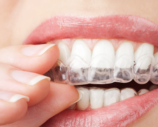 有人说长虎牙的人有点"虎",你认可吗?_牙齿_食物_位置