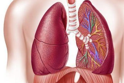 在肺癌的早期没有较多的症状,当肺癌细胞开始转移,出现颈部淋巴,纵膈
