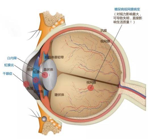 视网膜的位置图片图片
