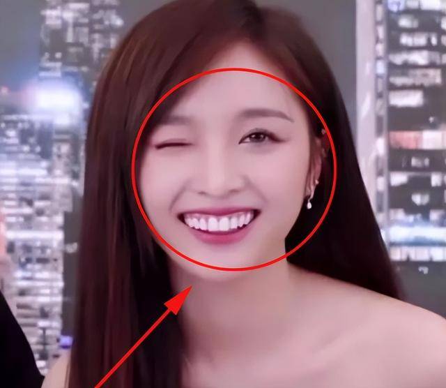 吴宣仪一开口笑,立刻吸引了人们的注意力,因为她满嘴都是牙齿,这种