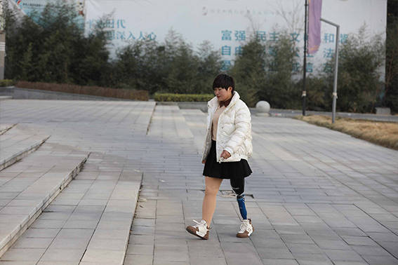 截肢患者在装配假肢前应如何做好残肢保养工作_绷带_弹性_皮肤