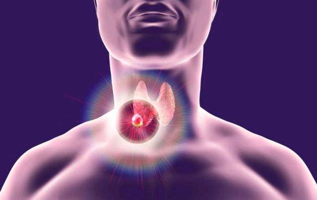 具有清热解毒,消肿散结的功效,因此被认为可以用来治疗甲状腺结节