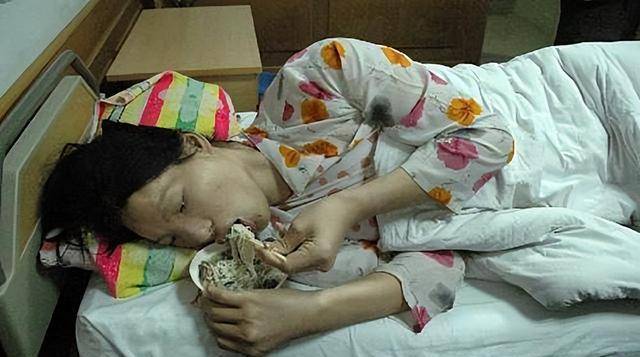 中国第一"女巨人",一顿吃2斤米饭,穿60码的鞋,遗体封存完整_曾金莲