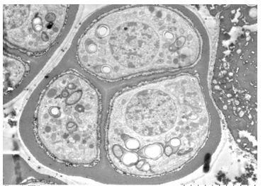 一文读懂生物透射电镜!_细胞_组织学_样品