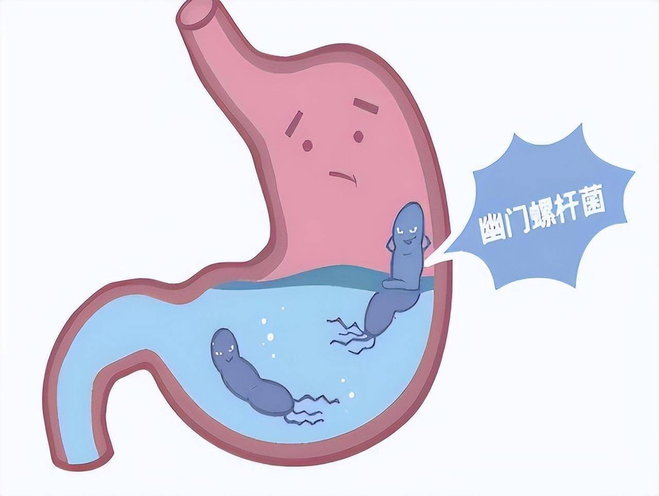 幽门螺旋杆菌"退退退":日常注意事项与科学饮食指南